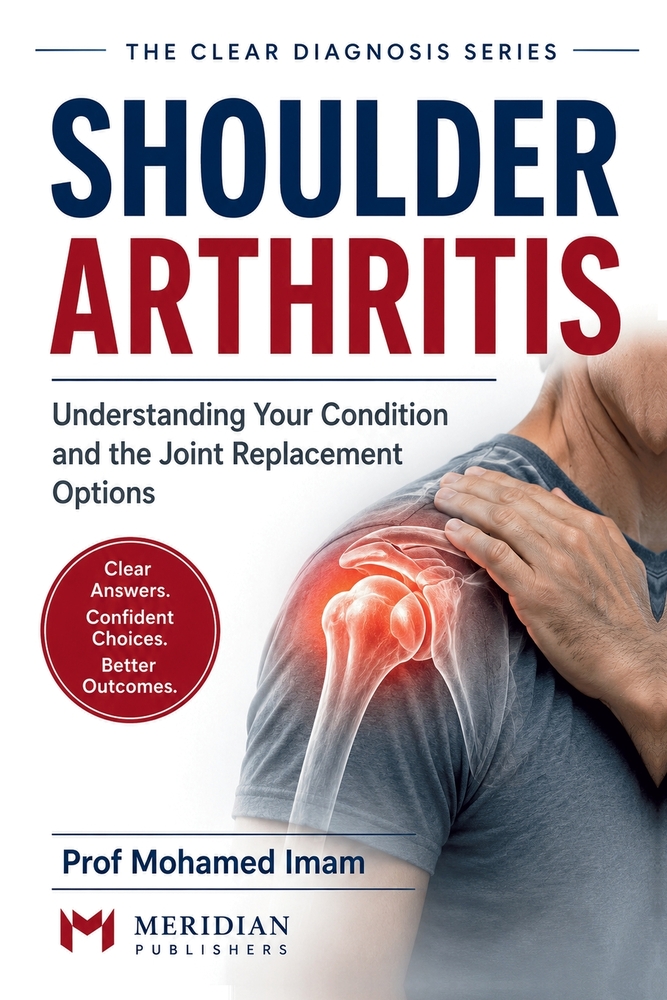 Shoulder Arthritis: Understanding Your Condition and the Joint Replacement Options cover