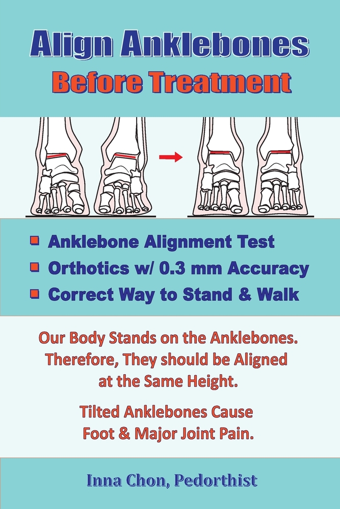 Align Anklebones Before Treatment cover