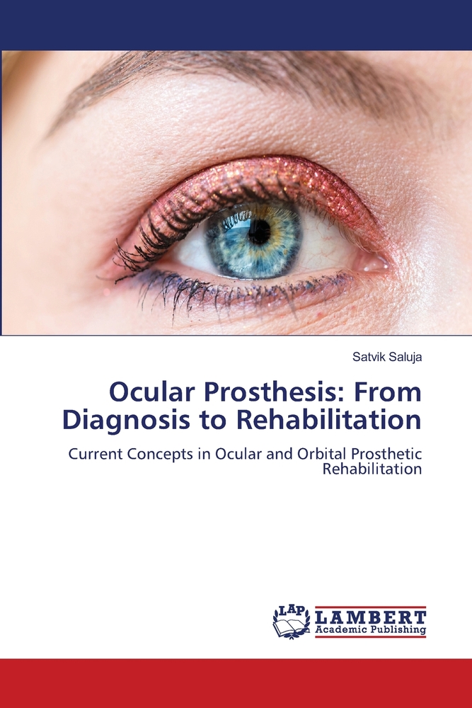 Ocular Prosthesis: From Diagnosis to Rehabilitation cover