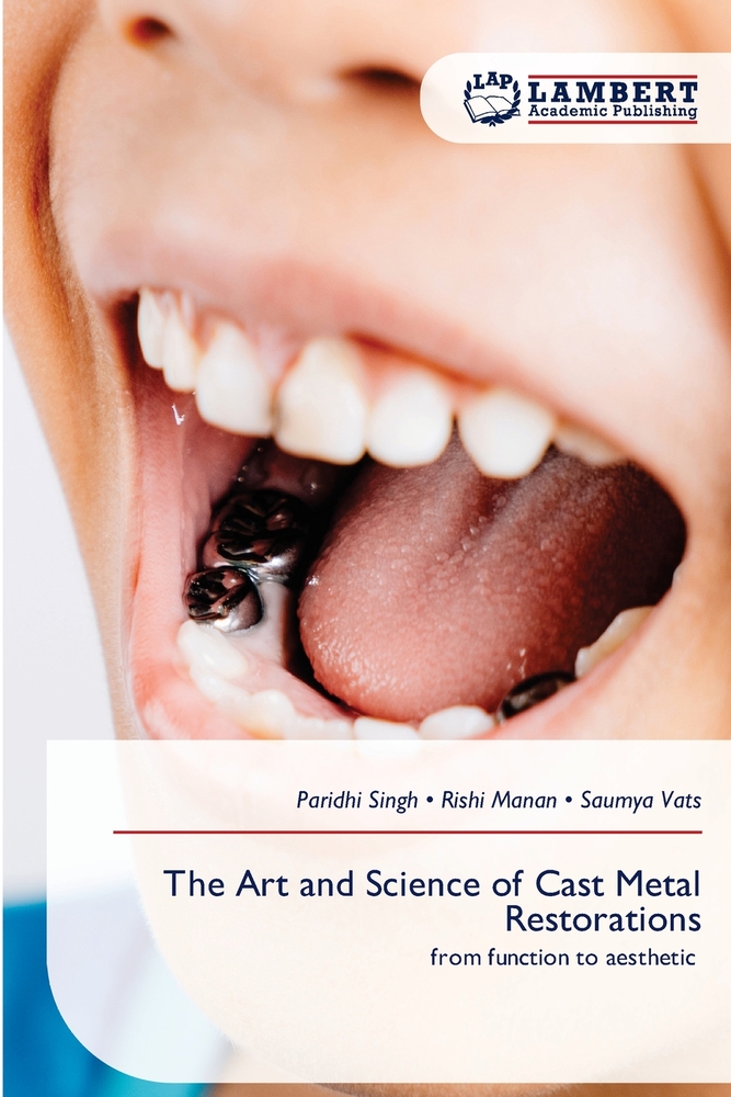 The Art and Science of Cast Metal Restorations cover