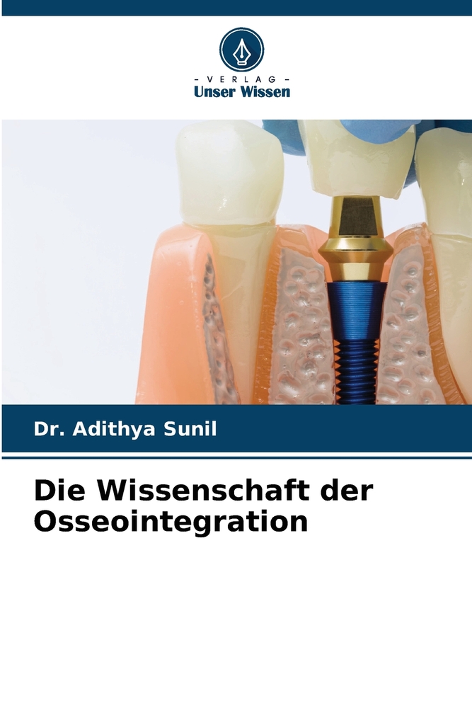 Die Wissenschaft der Osseointegration cover