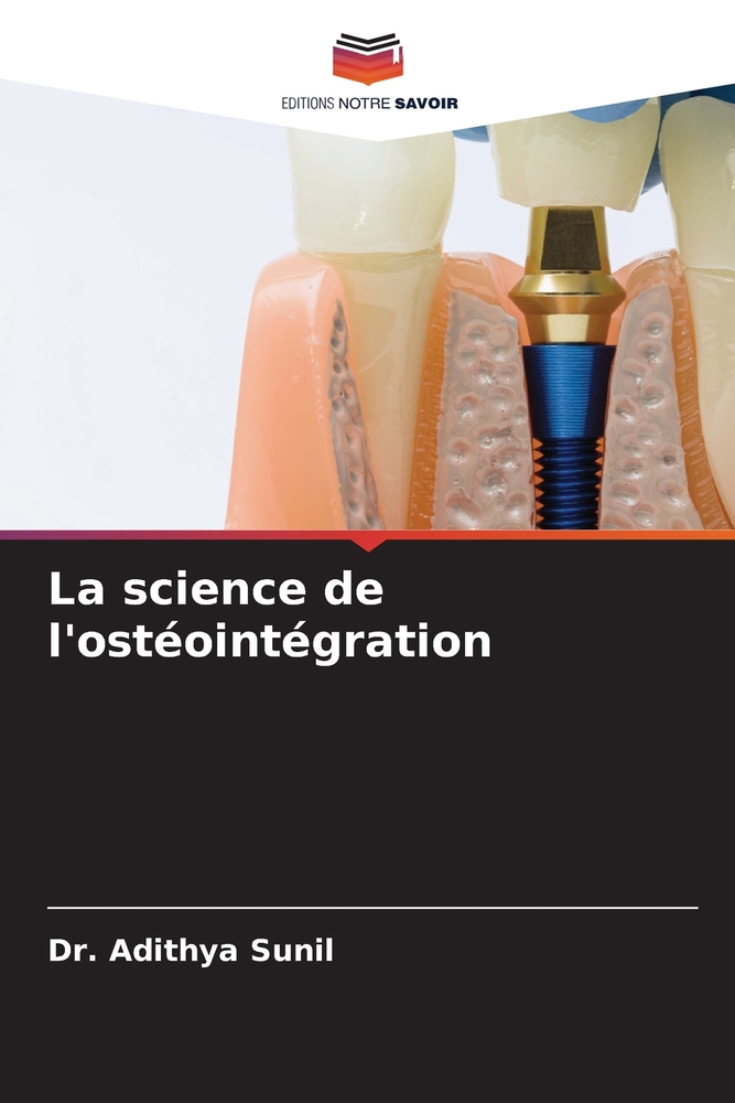 La science de l'ostéointégration cover