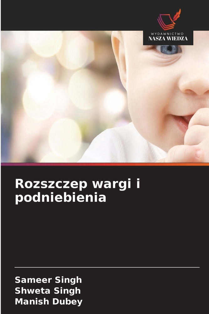 Rozszczep wargi i podniebienia cover