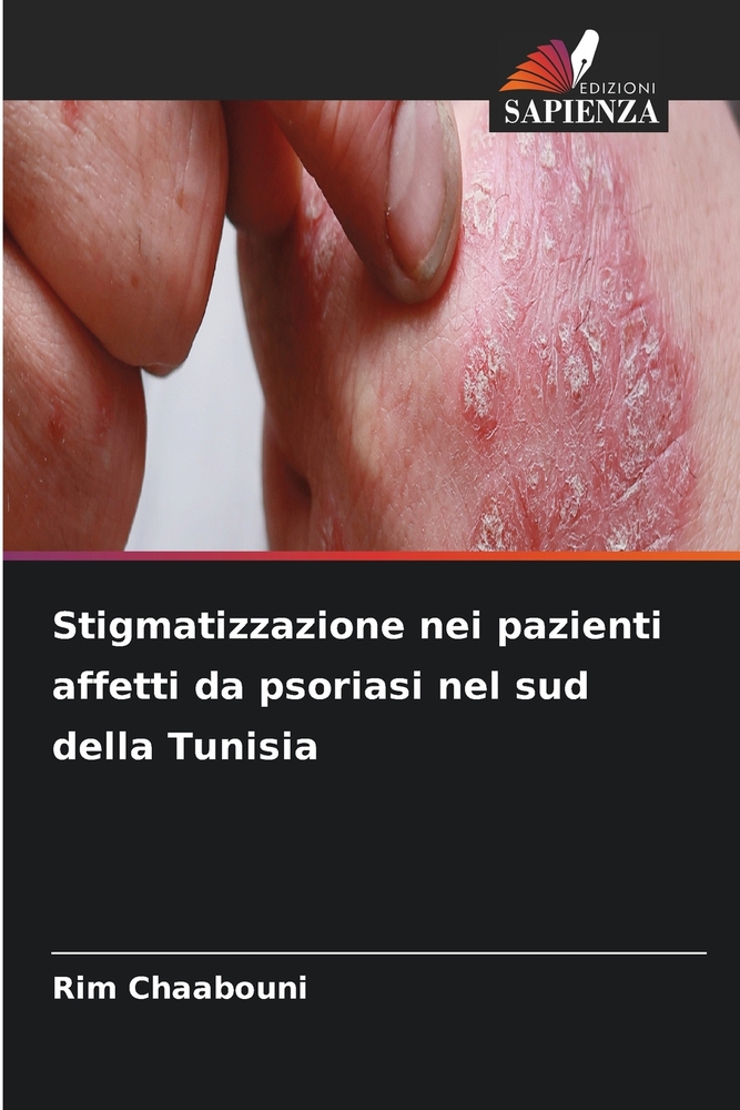 Stigmatizzazione nei pazienti affetti da psoriasi nel sud della Tunisia cover