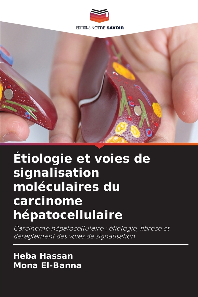Étiologie et voies de signalisation moléculaires du carcinome hépatocellulaire cover