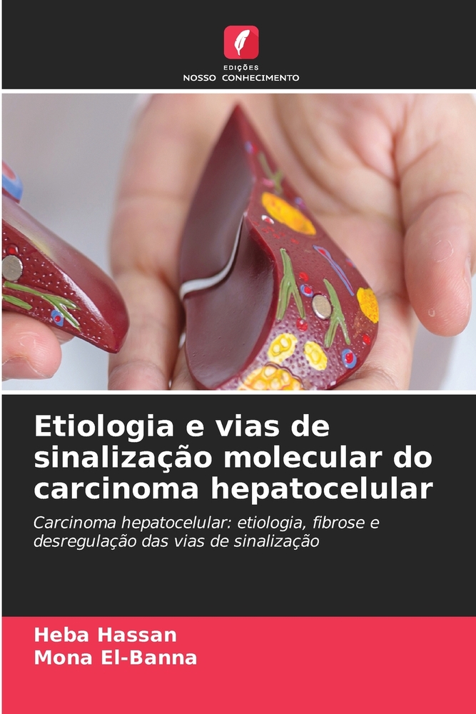Etiologia e vias de sinalização molecular do carcinoma hepatocelular cover