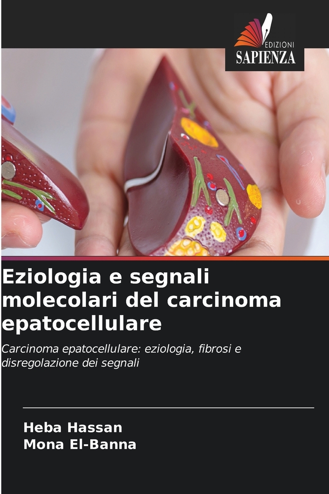 Eziologia e segnali molecolari del carcinoma epatocellulare cover