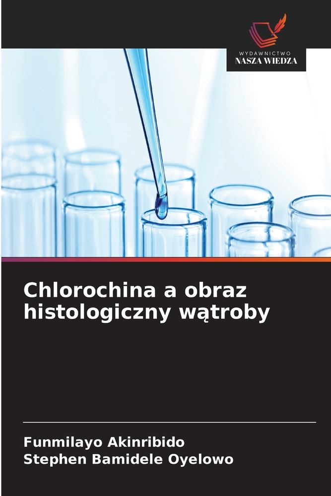 Chlorochina a obraz histologiczny wątroby cover