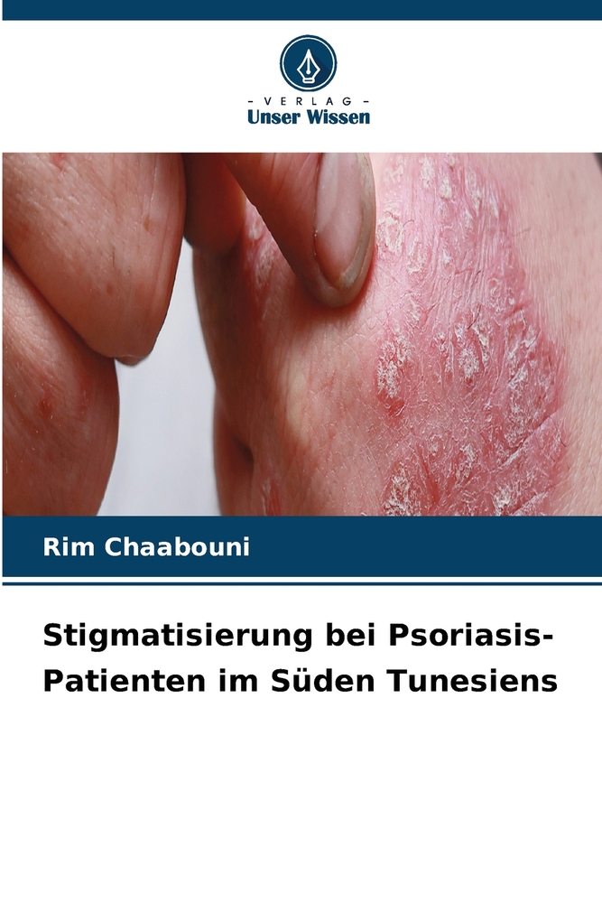 Stigmatisierung bei Psoriasis-Patienten im Süden Tunesiens cover
