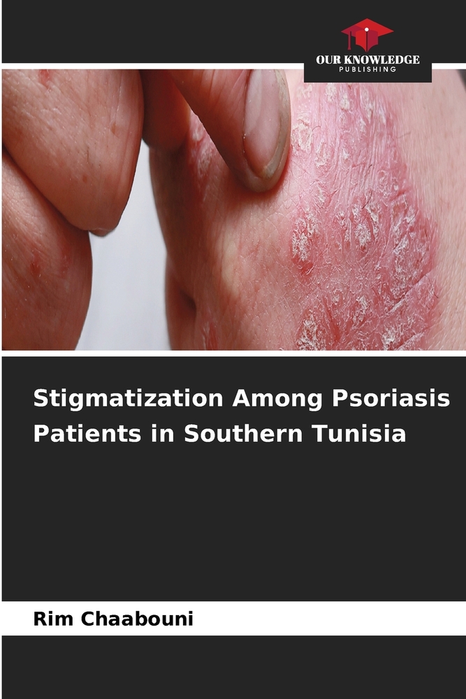 Stigmatization Among Psoriasis Patients in Southern Tunisia cover