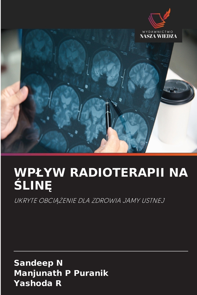 Wplyw Radioterapii Na ŚlinĘ cover