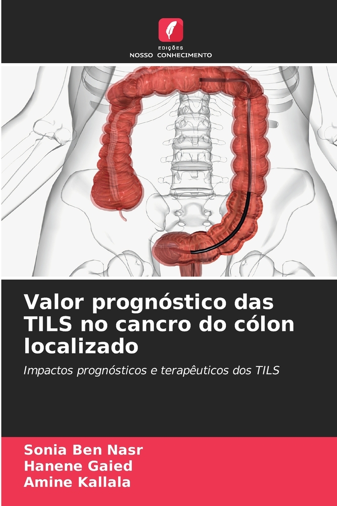 Valor prognóstico das TILS no cancro do cólon localizado cover