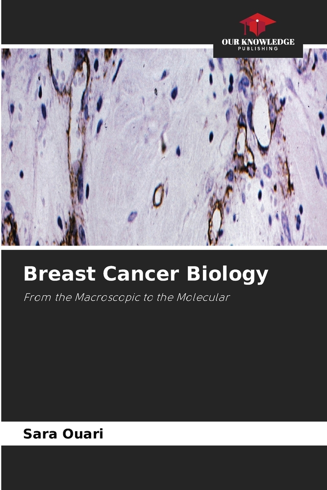 Breast Cancer Biology cover