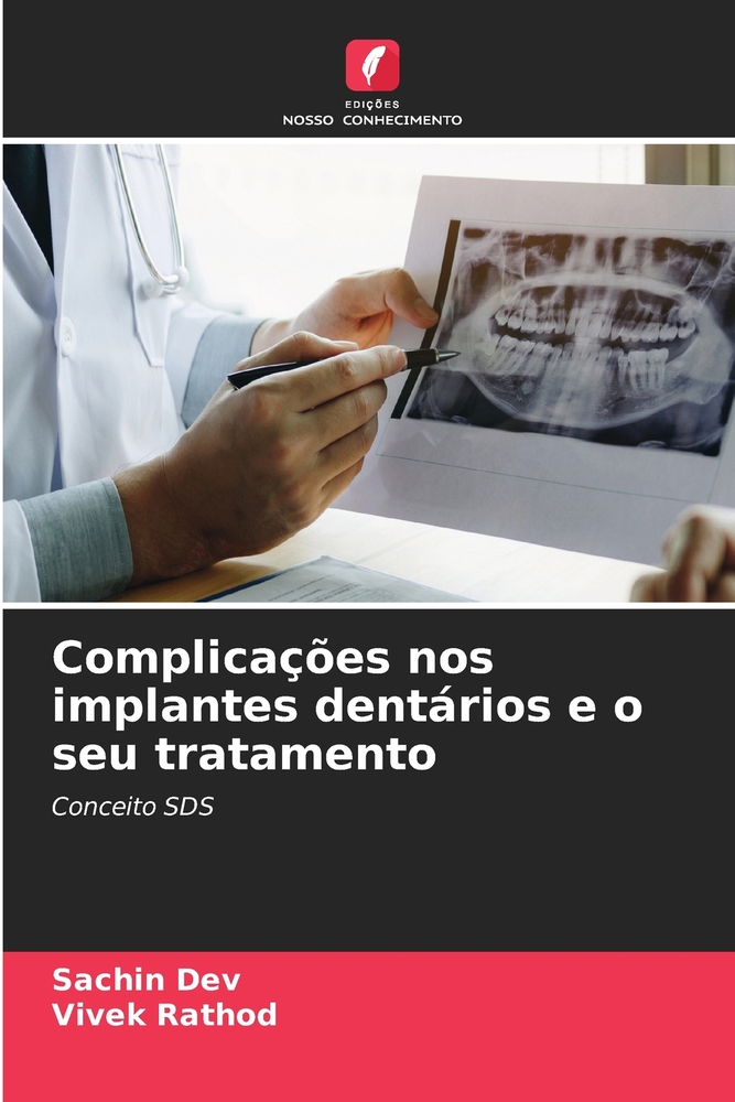 Complicações nos implantes dentários e o seu tratamento cover