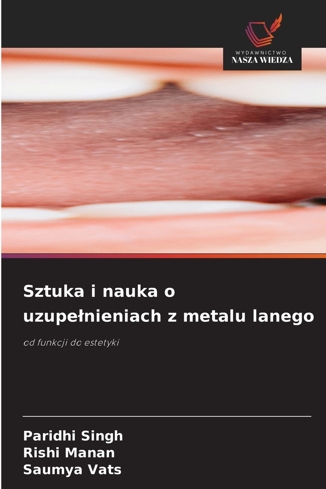 Sztuka i nauka o uzupelnieniach z metalu lanego cover