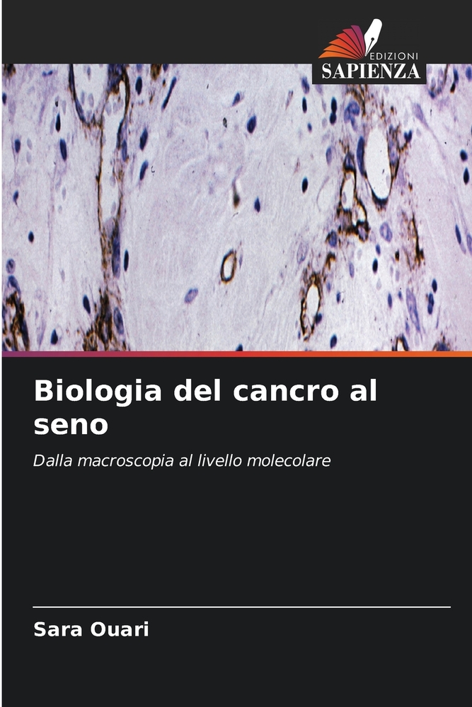 Biologia del cancro al seno cover