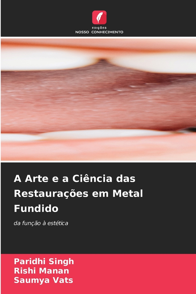 A Arte e a Ciência das Restaurações em Metal Fundido cover