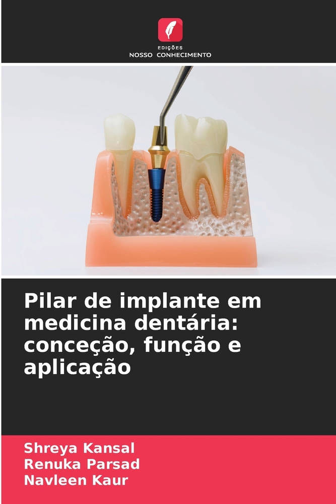 Pilar de implante em medicina dentária: conceção, função e aplicação cover