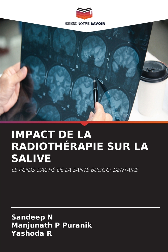 Impact de la Radiothérapie Sur La Salive cover
