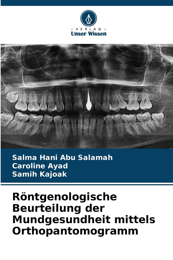 Röntgenologische Beurteilung der Mundgesundheit mittels Orthopantomogramm cover
