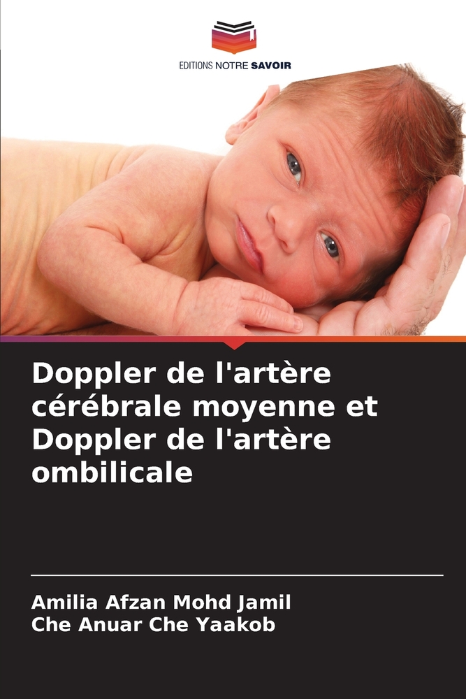 Doppler de l'artère cérébrale moyenne et Doppler de l'artère ombilicale cover