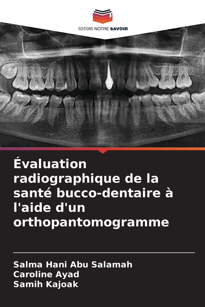 Évaluation radiographique de la santé bucco-dentaire à l'aide d'un orthopantomogramme cover