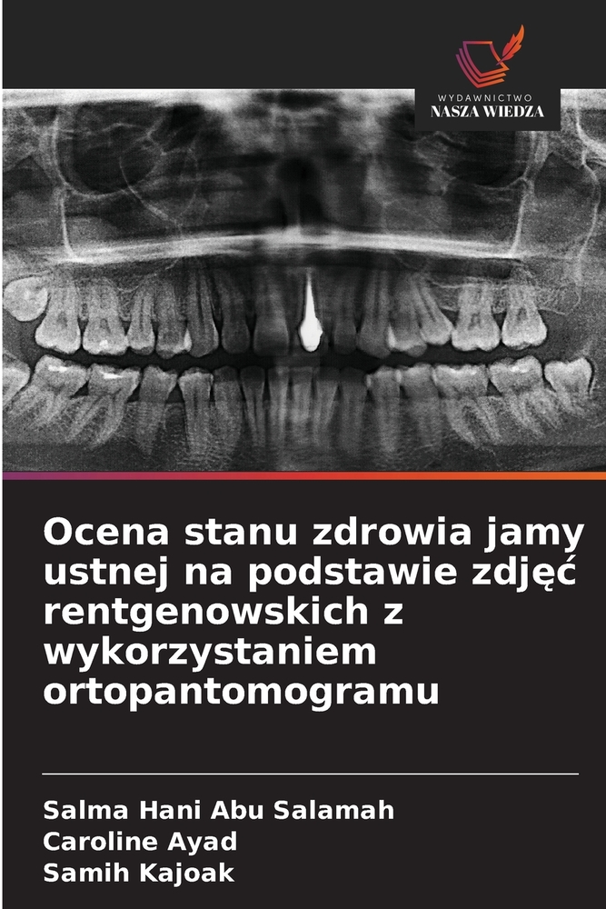 Ocena stanu zdrowia jamy ustnej na podstawie zdjęc rentgenowskich z wykorzystaniem ortopantomogramu cover
