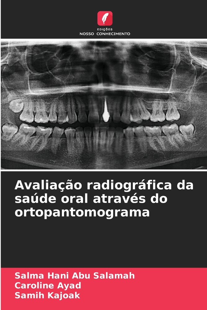 Avaliação radiográfica da saúde oral através do ortopantomograma cover