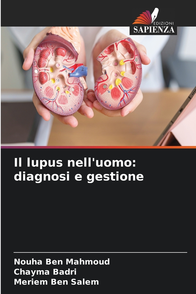 Il lupus nell'uomo: diagnosi e gestione cover