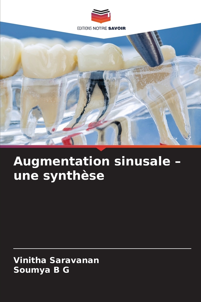Augmentation sinusale - une synthèse cover
