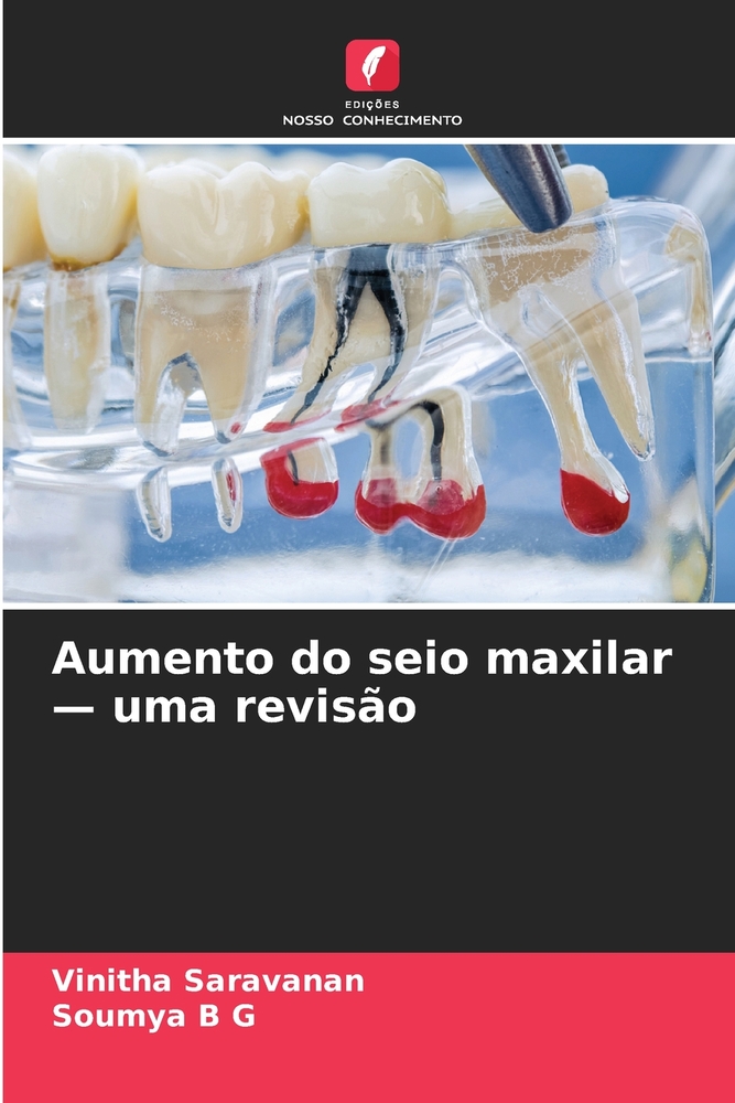 Aumento do seio maxilar - uma revisão cover