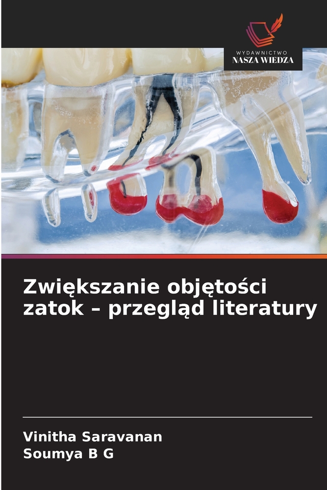 Zwiększanie objętości zatok - przegląd literatury cover
