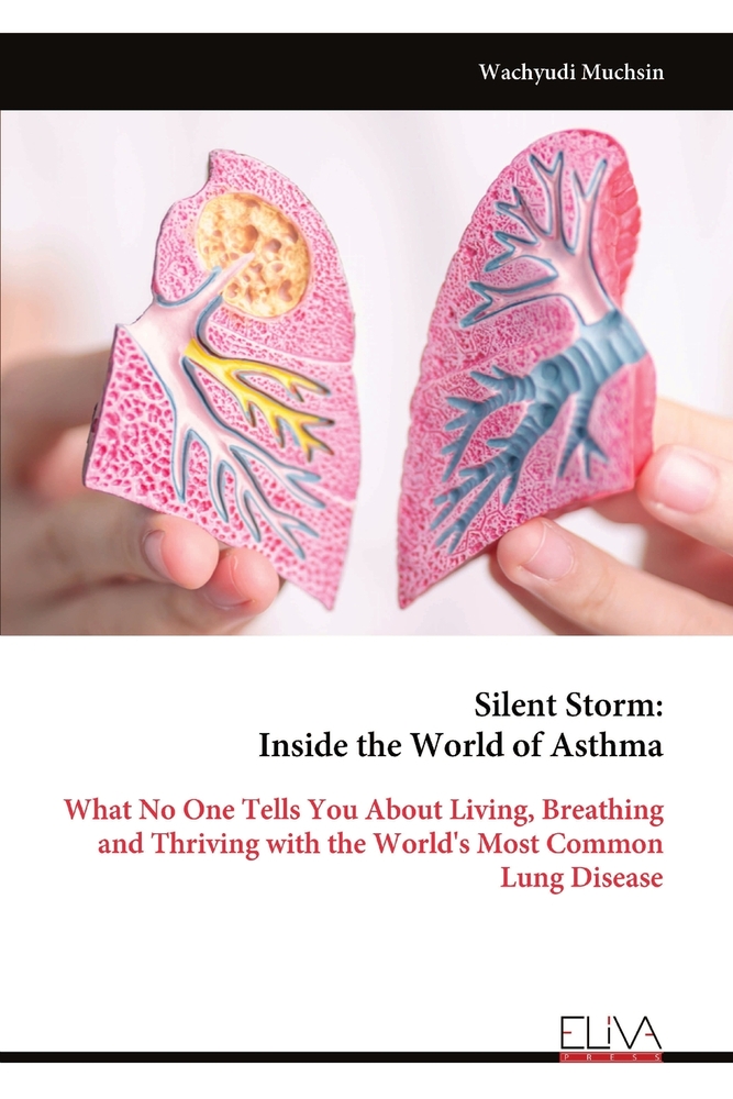 Silent Storm: Inside the World of Asthma: What No One Tells You About Living, Breathing and Thriving with the World's Most Common Lung Disease cover