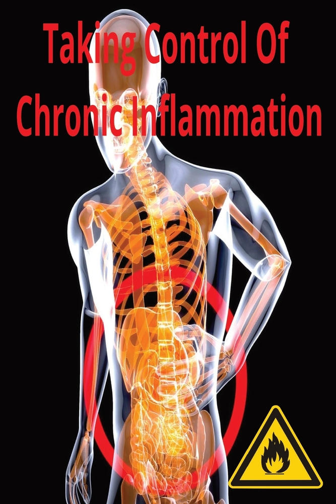 Taking Control Of Chronic Inflammation: No elixirs. No 30-day fixes. Just small, sustainable changes that add up. cover