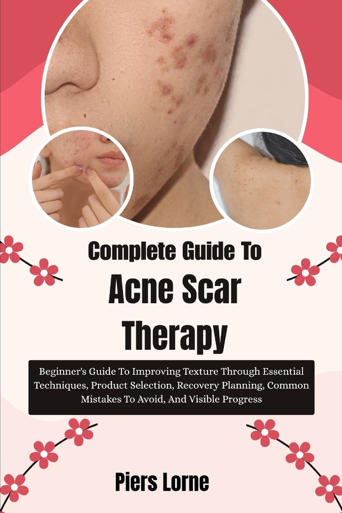 Complete Guide To Acne Scar Therapy: Beginner's Guide To Improving Texture Through Essential Techniques, Product Selection, Recovery Planning, Common cover