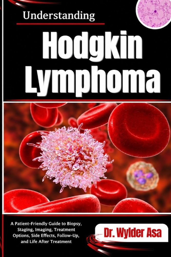Understanding Hodgkin Lymphoma: A Patient-Friendly Guide to Biopsy, Staging, Imaging, Treatment Options, Side Effects, Follow-Up, and Life After Treat cover
