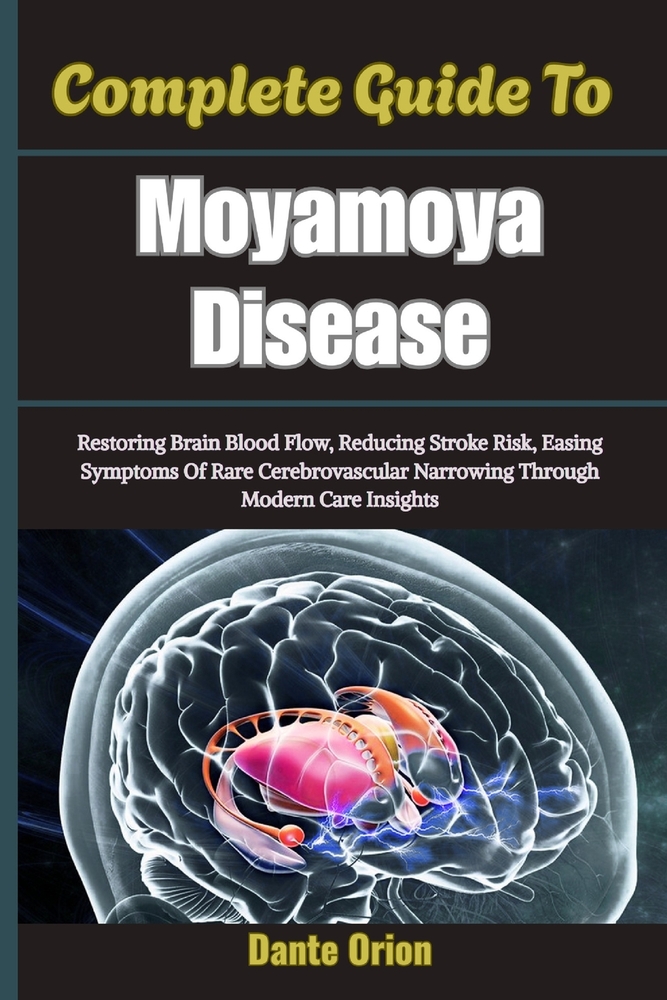 Complete Guide To Moyamoya Disease: Restoring Brain Blood Flow, Reducing Stroke Risk, Easing Symptoms Of Rare Cerebrovascular Narrowing Through Modern cover