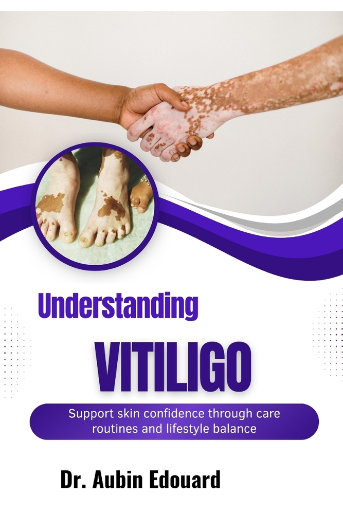 Understanding Vitiligo: Support skin confidence through care routines and lifestyle balance cover