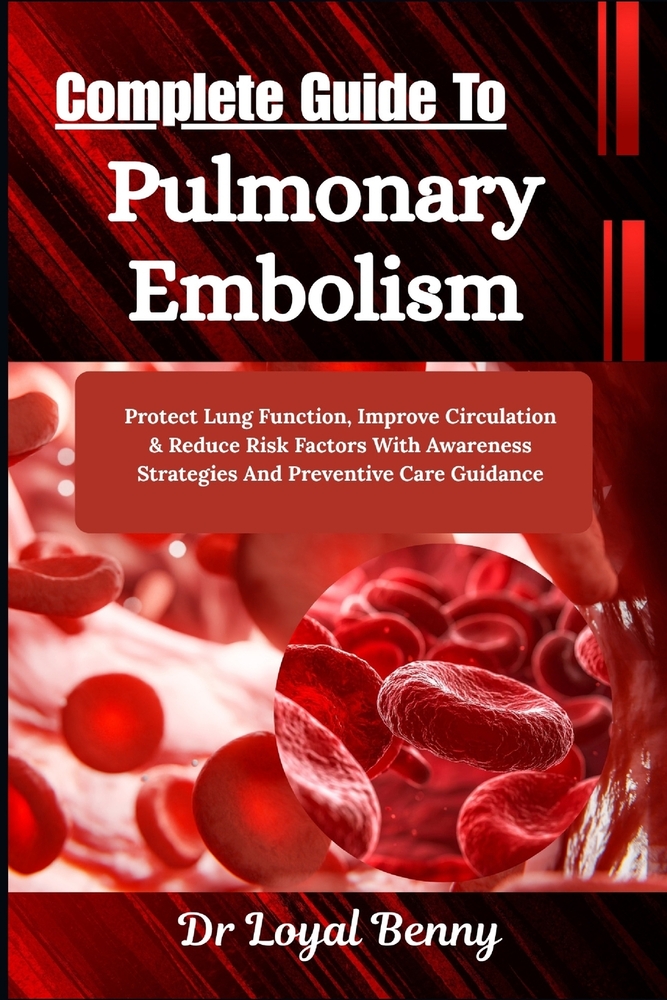 Complete Guide To Pulmonary Embolism: Protect Lung Function, Improve Circulation & Reduce Risk Factors With Awareness Strategies And Preventive Care G cover