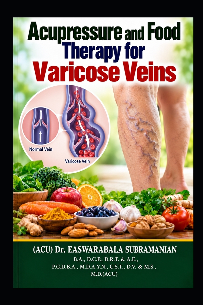 Acupressure and Food Therapy for Varicose Veins: Varicose Veins cover
