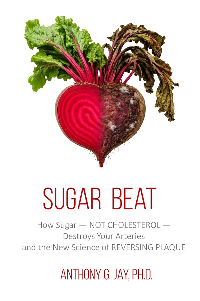 Sugar Beat: How Sugar - NOT CHOLESTEROL - Destroys Your Arteries and the New Science of REVERSING PLAQUE cover